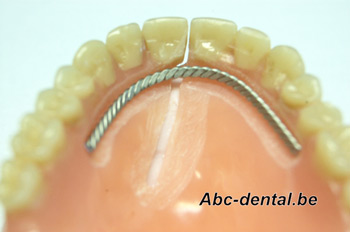 Dentier muni un fil de renfort