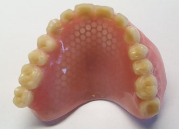 Dentier avec un renfort grille incrustée